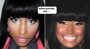 Nicki Minaj Nicki Minaj