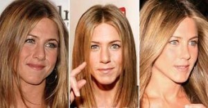 jennifer-aniston-nose-job-picture