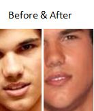 Celebrity nose jobs Celebrity nose jobs -The Taylor Lautner Nose Job -Before and After