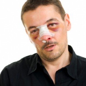 Tips on How to Recover from Rhinoplasty.jpg