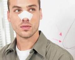 Septoplasty Post Operative Instructions buzzle Septoplasty - Deviate Septum