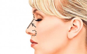 Is rhinoplasty worth it