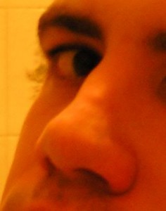 Rhinoplasty Recovery