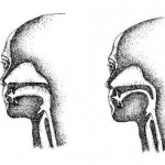 Disadvantages of Breathing from Your Mouth & a Deviated Nasal Septum
