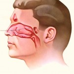 How to Find out If your Congested Nose is due to a Deviated Septum or Enlarged Turbinates