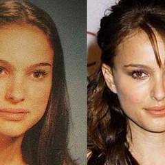 Natalie Portman Nose Job – Before & After