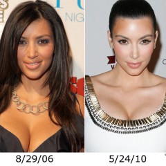 Kim Kardashian Nose Job – True or Not