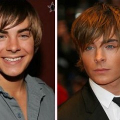 Zac Efron Nose Job – True or Not