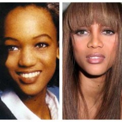 Tyra Banks Nose Job