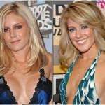 Heidi Montag Nose Job – Before and After