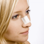 Signs and Symptoms of a Broken Nose