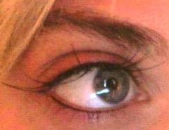 Can A Deviated Septum Cause Dark Puffy Bags Around Eyes