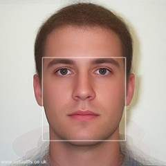 Transgender Nose Job for Feminine Look