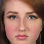 What You Must Consider When Fixing A Bad Nose Job