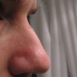 Male Rhinoplasty Helps You Achieve a More Masculine Look